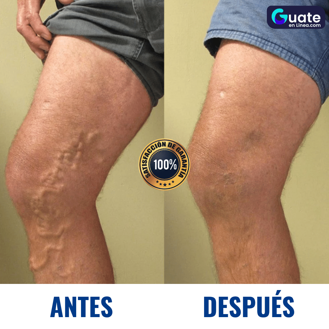 🦶🏻Masajeador Profesional con Terapias Avanzadas RelaxPro™